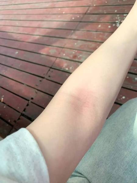 本人迄今为止认为去鸡皮最强的身体乳